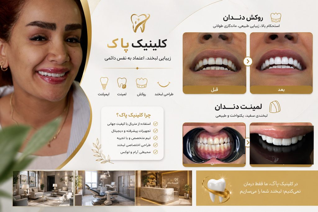 نمونه کار قبل و بعد از روکش و لمینت دندان